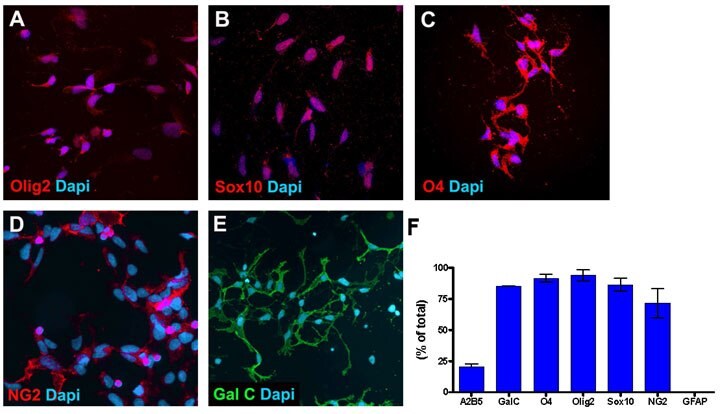 Oligodendrocyte Progenitor Cell Characterization