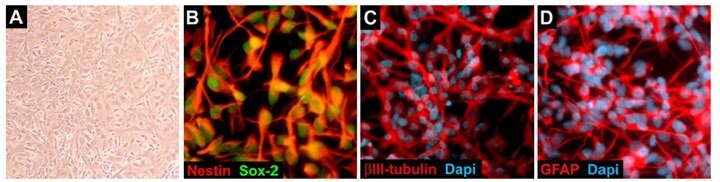 ReNcell VM Human Neural Progenitors