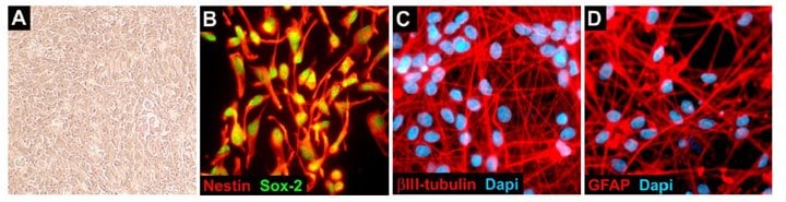 ReNcell CX Human Neural Progenitors