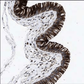 人鼻咽部的免疫组织化学染色使用Prestige Antibodies® Anti-DEFA5（货号HPA015775）显示呼吸道上皮细胞的细胞质和膜阳性。