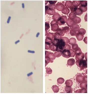 革兰氏染色（左边是革兰氏阳性蜡样芽孢杆菌，右边是革兰氏阴性柠檬酸杆菌）。