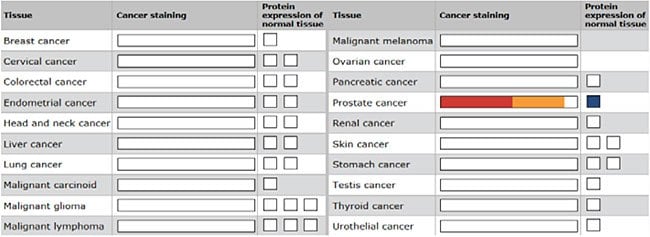 Example of antibody staining data in a range of cancer types