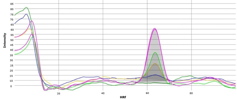 Overlay of chromatograms of standard solutions at concentrations of 0 μg/mL, 5μg/mL,10 μg/mL, 20 μg/mL, 50 μg/mL, and 70 μg/mL.