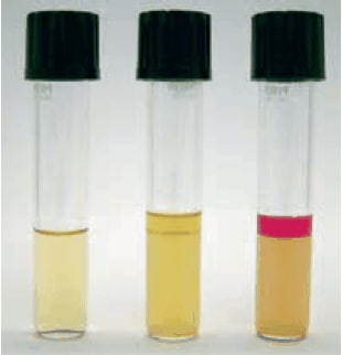 Kovac’s indole reaction (from left to right: blank, negative, positive)
