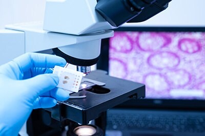 Photograph of hand holding tissue next to microscope 