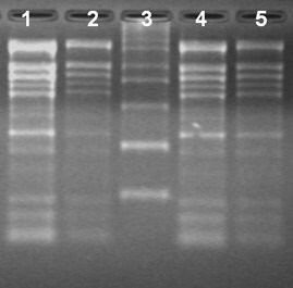 Total RNA Isolation from different ages of cotton leaves using the Spectrum™ Total RNA kit