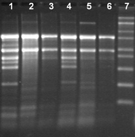 Total RNA Isolation from different tissue types of tobacco using the Spectrum™ Total RNA kit