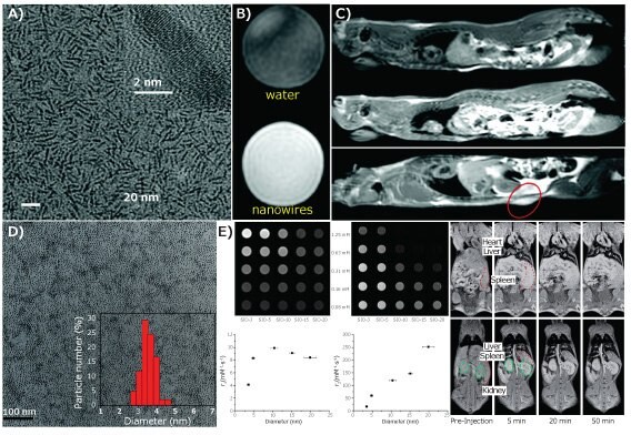 Transmission electron microscopy (TEM)