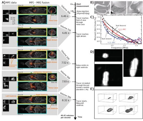 MPI,  MPI-MRI and TEM images