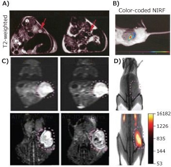 MRI-near Infrared (NIR) Optical Imaging