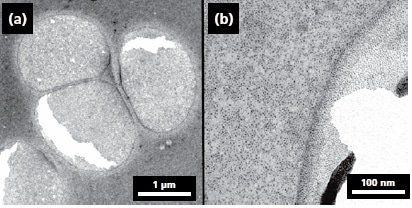 TEM (200 kV) images of ferritin molecules treated