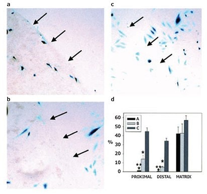 Collagen-mediated viral vector delivery. A) PDGF-B encoding adenovirus (AdPDGF-B) loaded PVA-collagen sponges in a rabbit ischemic wound model facilitated a 53% increase in granulation tissue relative to an empty sponge and repetitive dosages of PDGF-BB was required to achieve a comparable effect. B) Antibody-complexed adenovirus within a collagen- NeutrAvidinR promoted transgene β-galactosidase expression localized to the matrix as indicated in the representative images, where the arrows indicate the edge of the collagen matrix. (a) Complexed-adenovirus; (b) Non-complexed adenovirus; (c) No supplement. (d) The percentage of transfected rat arterial smooth muscle cells expressing β-galactosidase in the matrix, distal (within 100 mm) to the matrix, and proximal (>100 mm) from the matrix. Reprinted with permission from Mary Ann Liebert (Reference 13), copyright (2001), and Macmillan Publishers Ltd: Gene Therapy (Reference 14), copyright (2001).