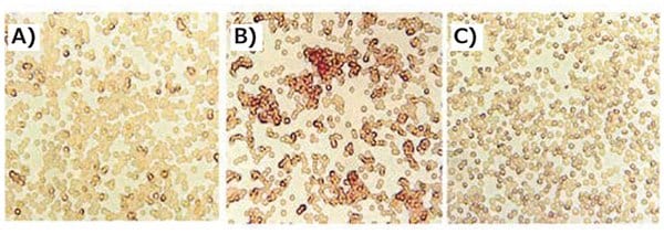 Incorporation of transferrin decreases erythrocyte aggregation. Fresh murine erythrocytes were incubated with PEI/DNA or Tf-PEI/PEI/DNA complexes (N/P = 4.8) for 1 h at 37 °C. A) Tf-PEI/PEI/ DNA, B) PEI/DNA, C) control. Adapted with permission from Kircheis et al.2 Copyright 2002 Nature Publishing Group. Incorporation of transferrin decreases erythrocyte aggregation