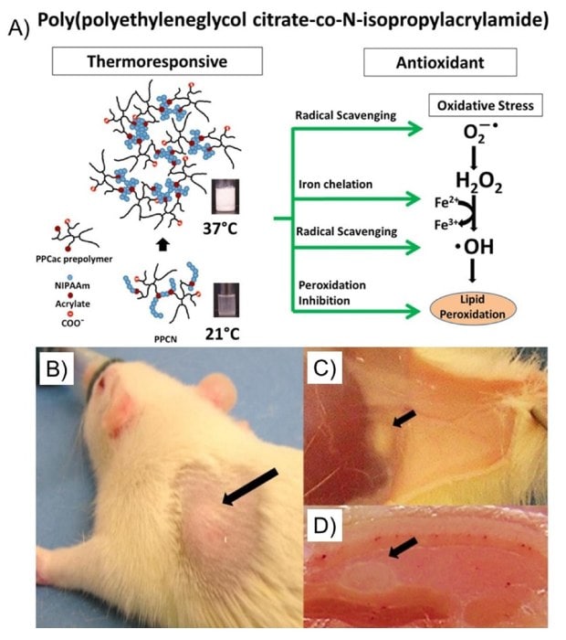 Schematic of thermoresponsive poly(polyetheylene glycol citrate-co-N-isopropylacrylamide) gel formation and antioxidant properites