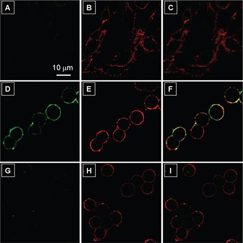 Confocal laser scanning microscopy (CLSM) images of live cells after incubation with 2 μM TPS-2cRGD in the absence and presence of a membrane tracker