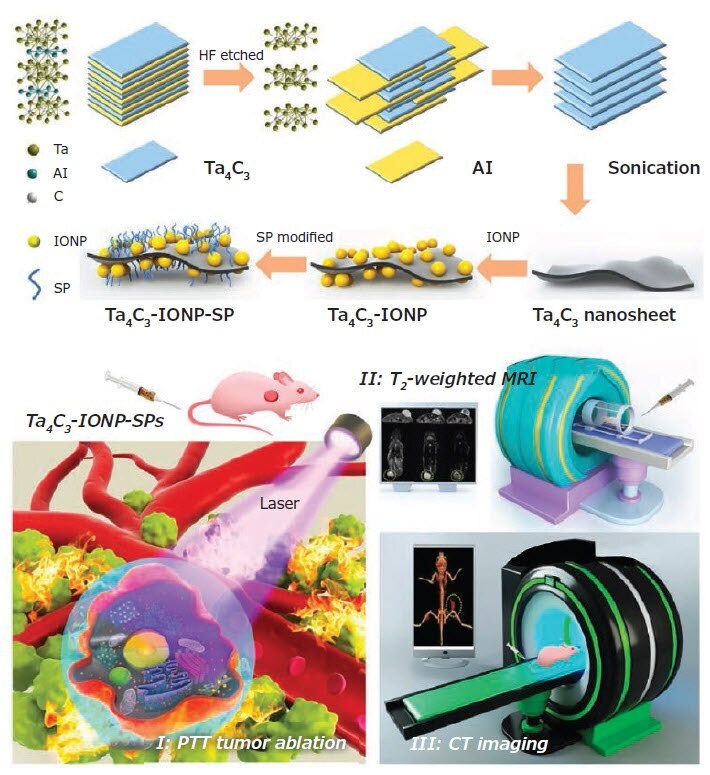 Schematic illustration of the fabrication process of Ta4C3-IONP-SPs