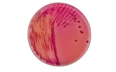 Chromocult® Rambach agar media for Salmonella detection