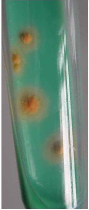 在L&ouml;wenstein-Jensen TB培养基上生长的分枝杆菌菌落
