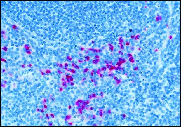 Formalin-fixed, paraffin-embedded section of human tonsil stained with Anti-Human IgG (gamma -chain specific)-Alkaline Phosphatase Conjugate, F(ab)2 fragment of goat antibody (Cat. No. A3312) using SIGMA FAST™ Fast Red TR/Naphthol AS-MX Tablets (Cat. No. F4523) as substrate.