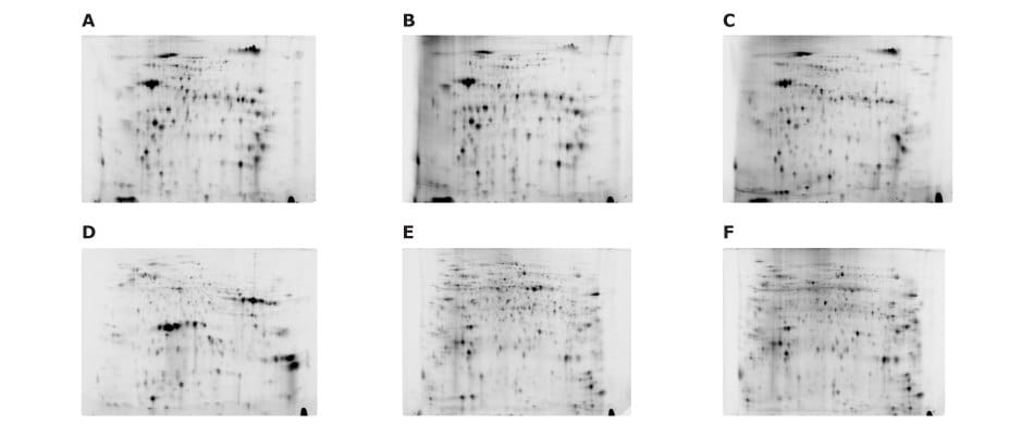 Fluorescence-labeled 2D-E images of plant organ samples using the Auto2D®automated gel electrophoresis system. Images include juice, inner skin, jelly-like tissue, seed, sepal, and pedicel. Each sample has a clear and differentiated profile.