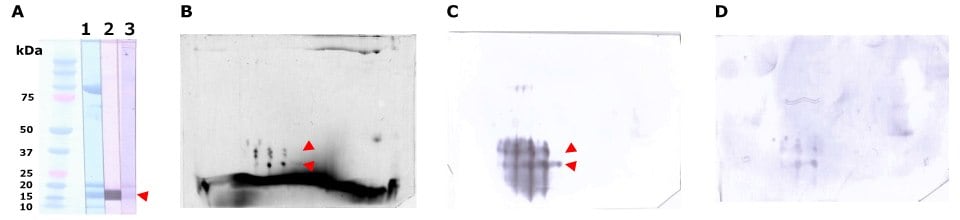 The Auto2D system for salmon roe-allergenic patient serum separation and immunodetection.