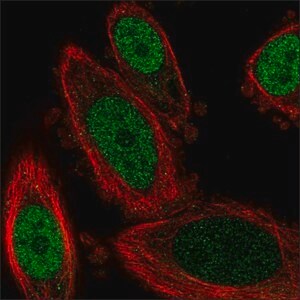 Immunofluorescent staining showing nuclear localization of transcription factor