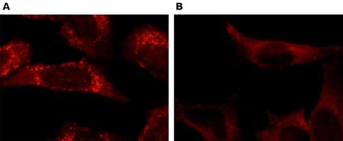 immunofluorescence