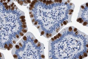 Immunoperoxidase staining of formalin-fixed, paraffin-embedded human small intestine shows strong intracellular proteinaceous material positivity in glandular cells