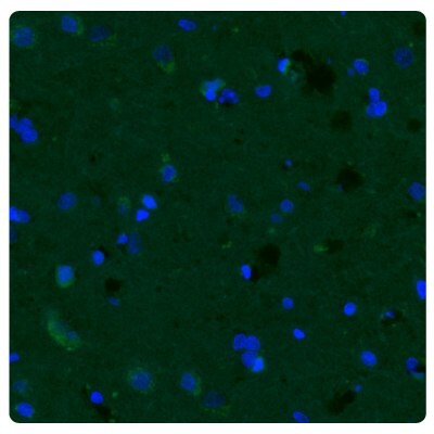 Immunostaining with fluorescence immunohistochemistry of human normal cortex tissue samples stained with the Anti-CHI3L1 antibody (Product No. AMAb91777).