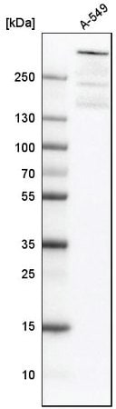 使用抗ATRX抗体进行蛋白质免疫印迹分析