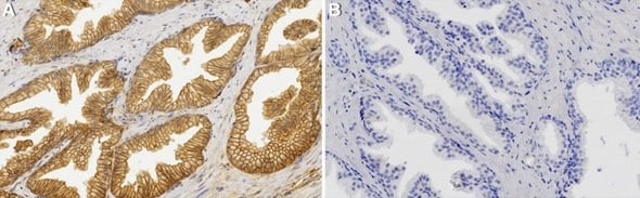 ZooMAb® antibody staining on human prostate sections In image A, large ovals cover the image, the outside stained with the ZooMAb® antibody and representing the membrane staining. In image B, small ovals are scattered over the image, but the large ovals are not visible.