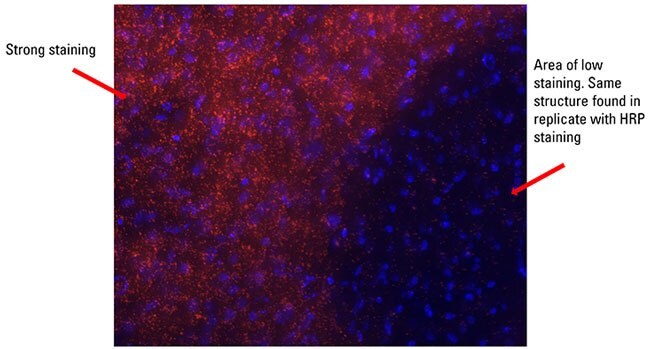 Duolink Fluorescence Detection