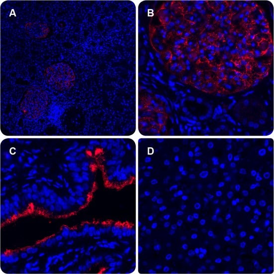 In situ PLA® – Application Example Immunofluorescence PLA signal shows protein-protein interactions