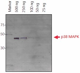 Detection of Histidine-Tagged Proteins after Western Blot Transfer