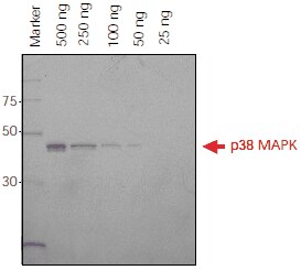 在 SDS-PAGE 凝胶上直接检测组氨酸标记蛋白