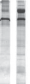 Western Blotting Sample Preparation Comparison of SDS-PAGE Clean-Up Kit with ethanol precipitation