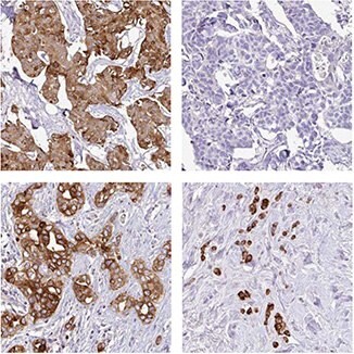 anti-agr3-antibody