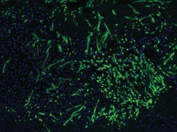 Fluorescent microscopy of human skin tissue section