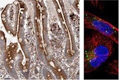 使用-抗-grn-抗体-的-ihc-分析