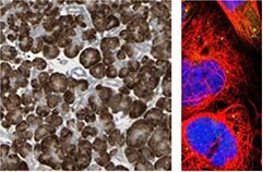 ihc-staining-of-human-pancreas-tissue ihc-staining-of-human-pancreas-tissue