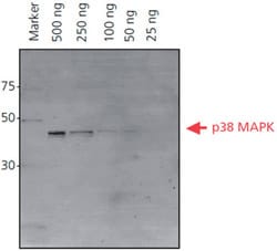 Atto Dyes for Superior Fluorescent Imaging His-tagged p38 MAPK protein