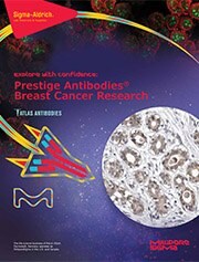 prestige antibodies