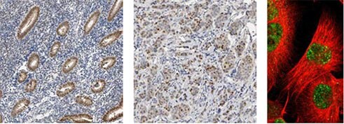 Progesteron Receptor Progesteron Receptor