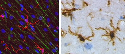 Microglia resident in the brain regulate neuroinflammation
