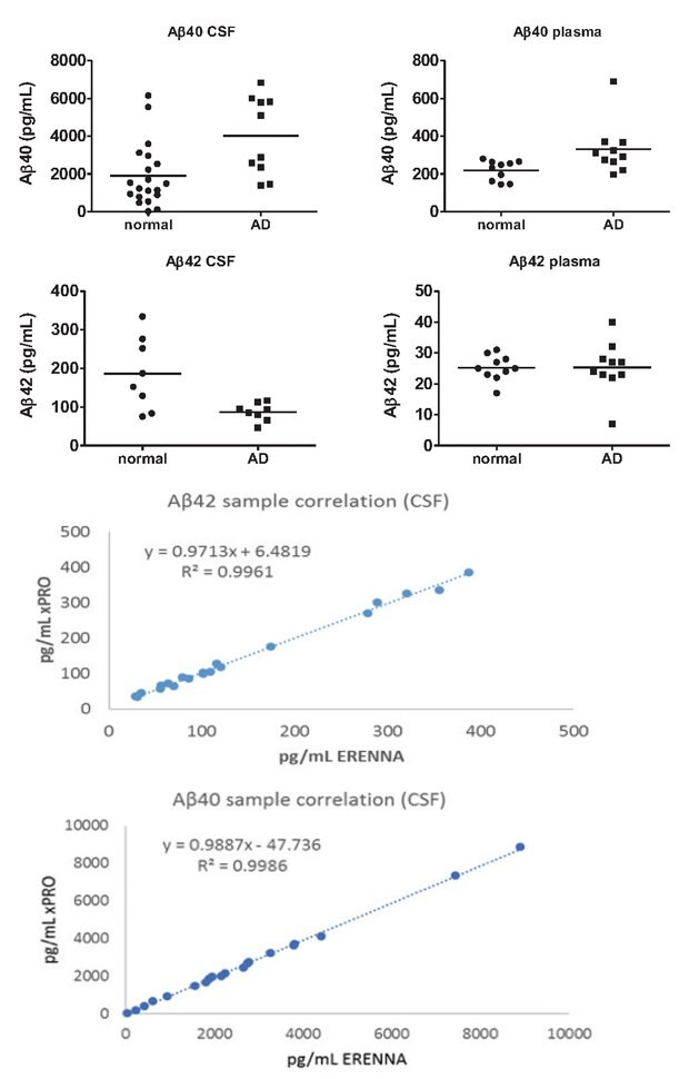 SMC® high sensitivity immunoassay biomarker measurement in normal and AD plasma and serum samples and CSF sample correlations for Aβ42 and Aβ40.