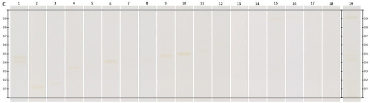 Chromatograms under UV