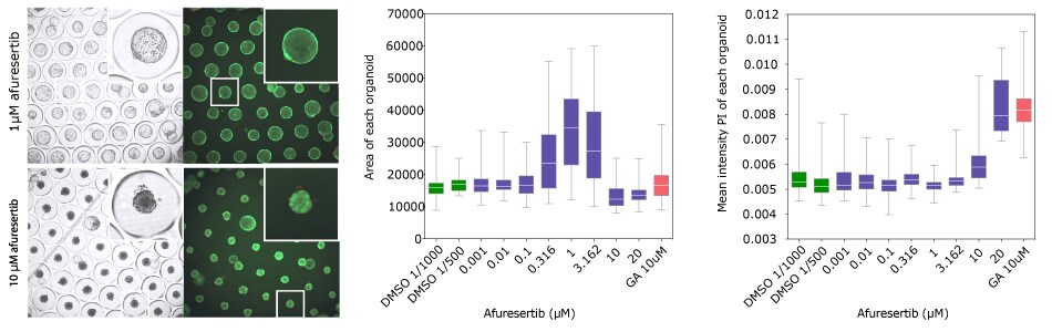 Fluorescence microscopy imaging of organoid size and quantification at increasing concentrations of afuresertib