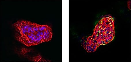 H. pylori infection of apical-out gastric organoids H. pylori infection of apical-out gastric organoids