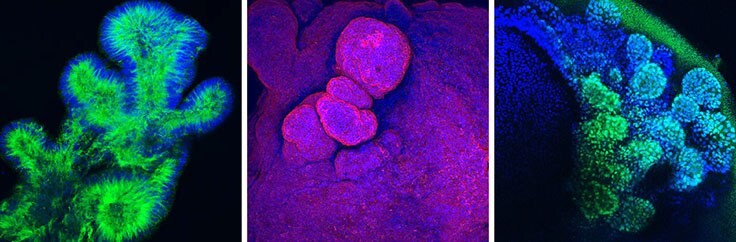 Immunofluorescence of organoids using antibodies