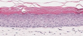 In-Vitro Organotypic Skin Culture-a <b>A</b>. <i>In-Vitro</i> Organotypic Skin Culture